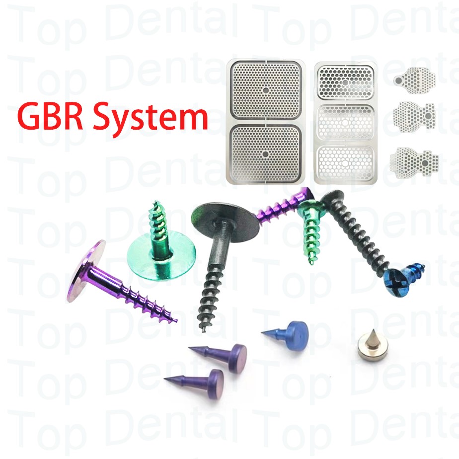 Stabilizer Screw In - 10 pçs sistema dental gbr parafusos