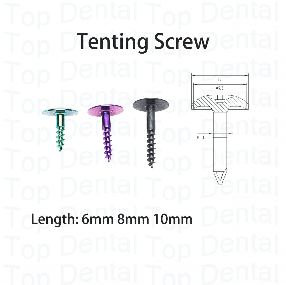 10 pçs sistema dental gbr para - Stabilizer Screw In avaliação e preço
