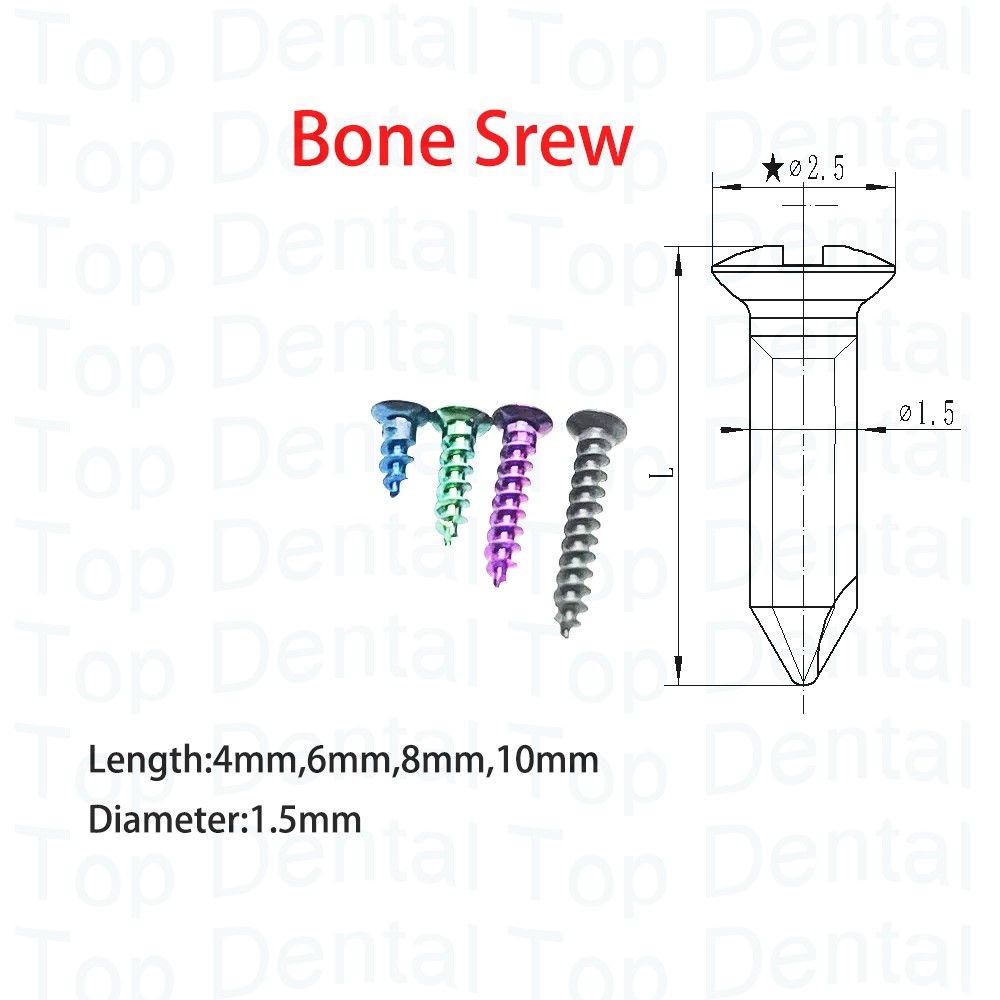 10 pçs sistema dental gbr para - Stabilizer Screw In avaliação e preço
